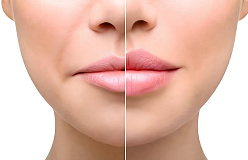 Январь в центре косметологии и дерматологии KODERM: скидки на услуги и абонементы Январь в центре косметологии и дерматологии KODERM: скидки на услуги и абонементы