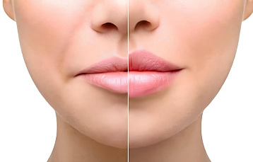 Январь в центре косметологии и дерматологии KODERM: скидки на услуги и абонементы